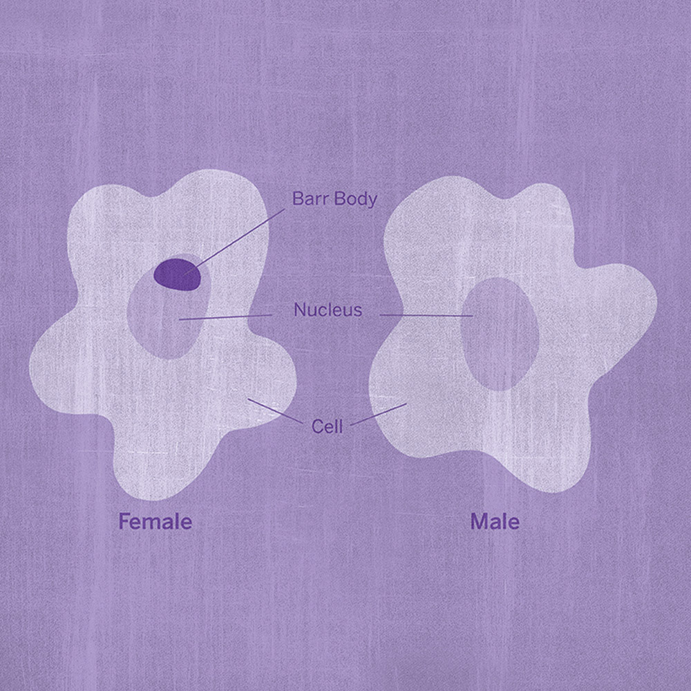 An illustration of two cells, one of which has a Barr Body in its nucleus.