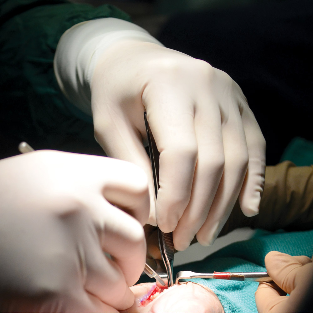 A photograph of doctors performing surgery.