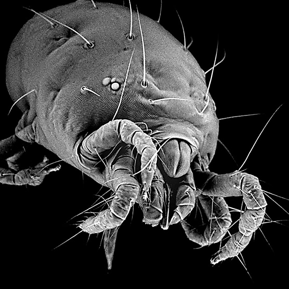 A magnified image of a spider mite.