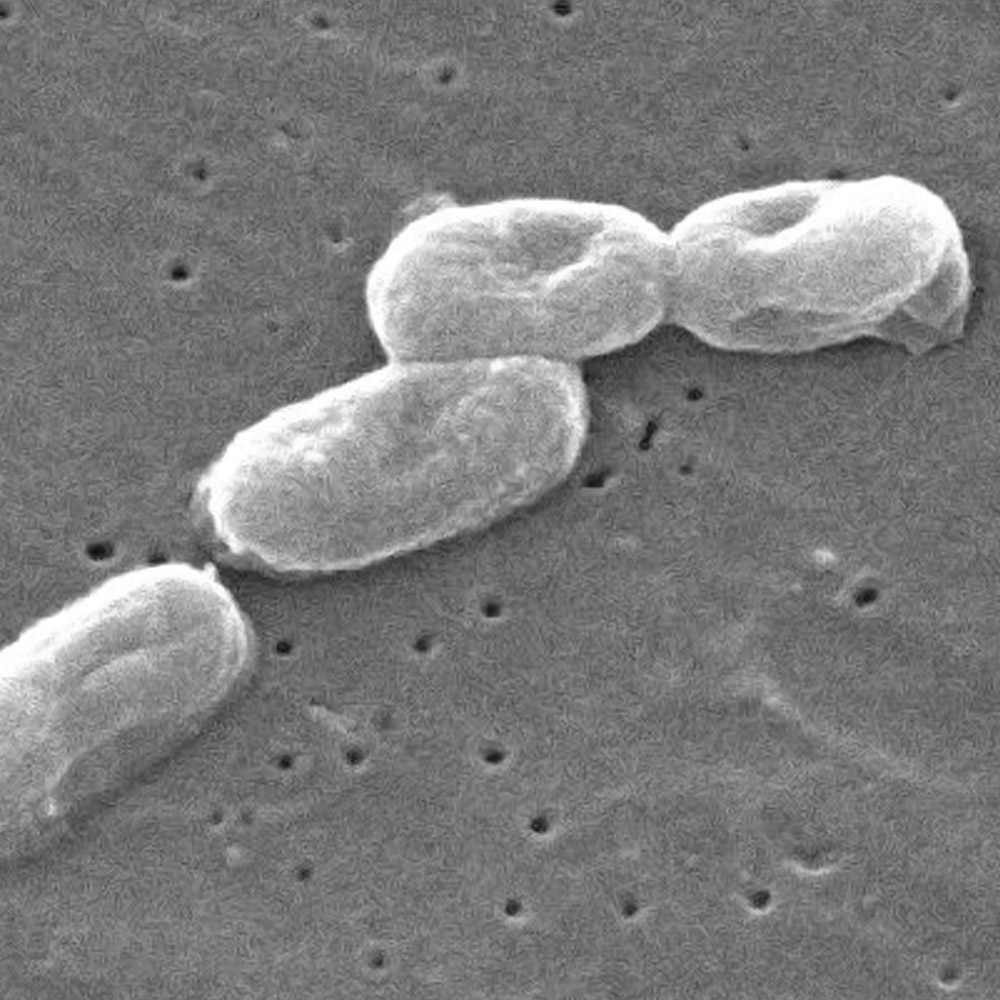 A magnified x-ray of a cell.