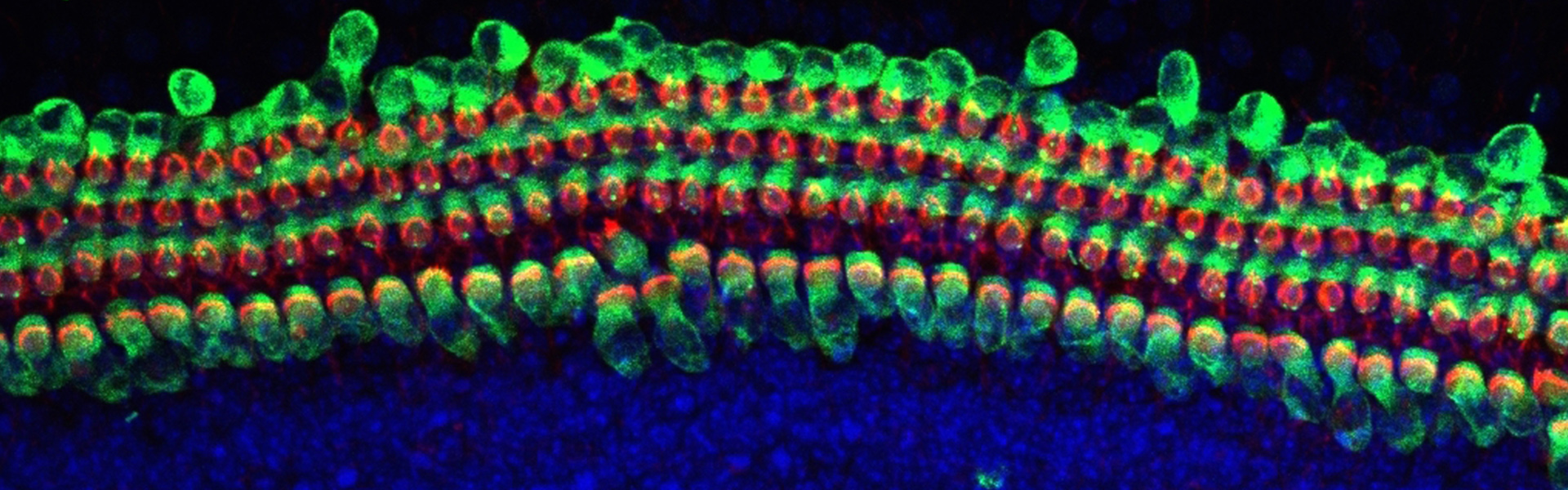 Rows of Sensory Hair Cells in Mouse Cochlear Culture