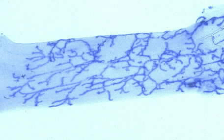 Skeletal Muscle