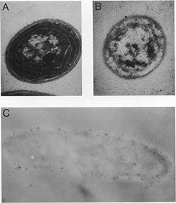 bacterial work by Dr. Laudenbach