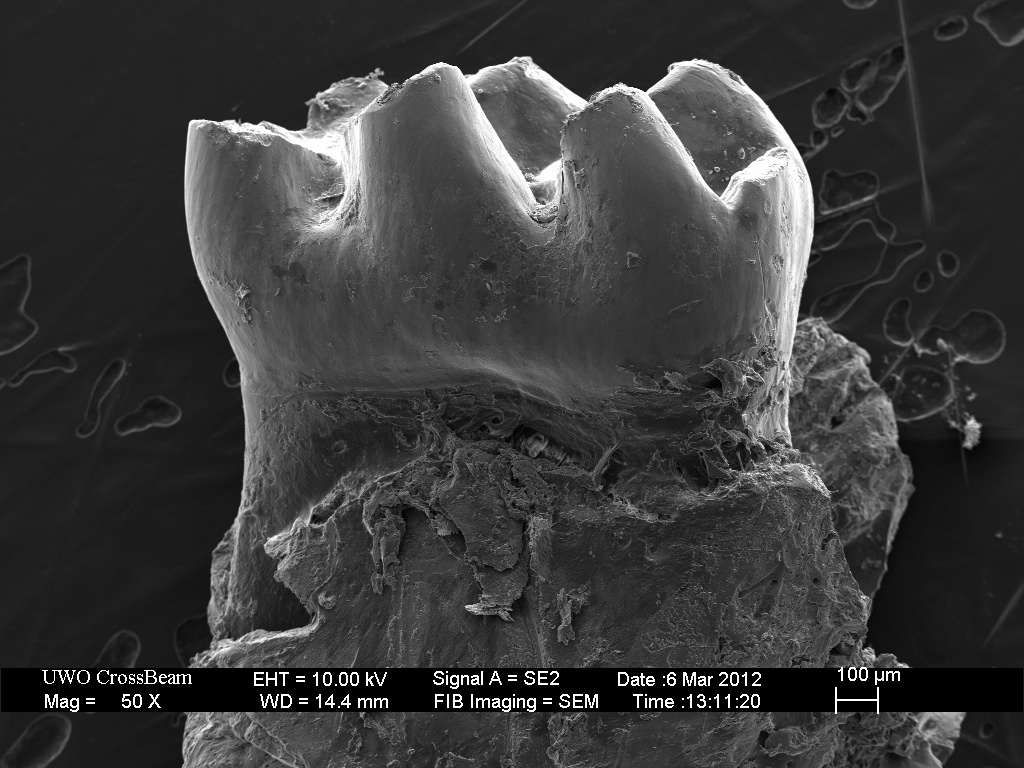  Tooth 