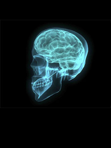 xray of skull