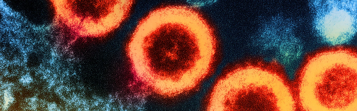 HIV Cells on an electron image