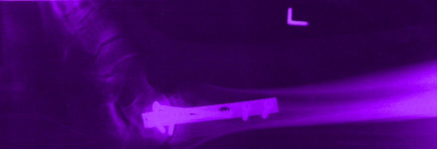 Implant-banner.jpg