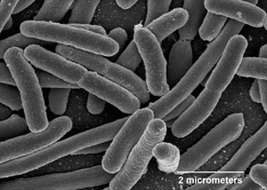 An electronmicrograph of E. coli